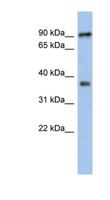 RSPH10B antibody LS-C111782 Western blot of Jurkat lysate.