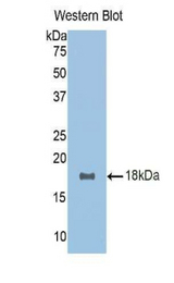 Western blot of recombinant RSPO1 / RSPO.