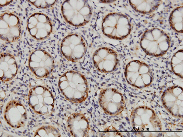 Immunoperoxidase of monoclonal antibody to PSMB6 on formalin-fixed paraffin-embedded human colon. [antibody concentration 1 ug/ml]