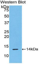 Western blot of recombinant RSPO1 / RSPO.