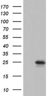 HEK293T cells were transfected with the pCMV6-ENTRY control (Left lane) or pCMV6-ENTRY RSPO1 (Right lane) cDNA for 48 hrs and lysed. Equivalent amounts of cell lysates (5 ug per lane) were separated by SDS-PAGE and immunoblotted with anti-RSPO1.