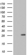 HEK293T cells were transfected with the pCMV6-ENTRY control (Left lane) or pCMV6-ENTRY RSPO1 (Right lane) cDNA for 48 hrs and lysed. Equivalent amounts of cell lysates (5 ug per lane) were separated by SDS-PAGE and immunoblotted with anti-RSPO1.