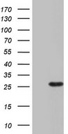 HEK293T cells were transfected with the pCMV6-ENTRY control (Left lane) or pCMV6-ENTRY RSPO1 (Right lane) cDNA for 48 hrs and lysed. Equivalent amounts of cell lysates (5 ug per lane) were separated by SDS-PAGE and immunoblotted with anti-RSPO1.