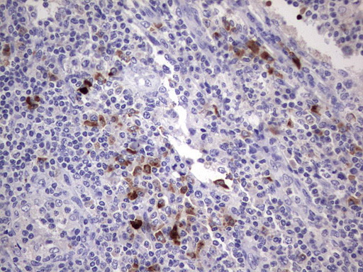 IHC of paraffin-embedded Human lymph node tissue using anti-RSPO1 mouse monoclonal antibody. (Heat-induced epitope retrieval by 1 mM EDTA in 10mM Tris, pH8.5, 120°C for 3min).