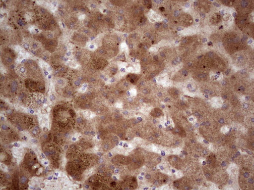 IHC of paraffin-embedded Human liver tissue using anti-RSPO3 mouse monoclonal antibody. (heat-induced epitope retrieval by 1 mM EDTA in 10mM Tris, pH8.5, 120°C for 3min).