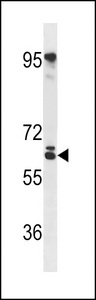 RSPRY Antibody western blot of mouse NIH-3T3 cell line lysates (35 ug/lane). The RSPRY antibody detected the RSPRY protein (arrow).