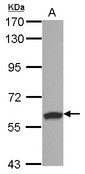 Sample (30 ug of whole cell lysate) A: NT2D1 7.5% SDS PAGE RSPRY1 antibody diluted at 1:1000