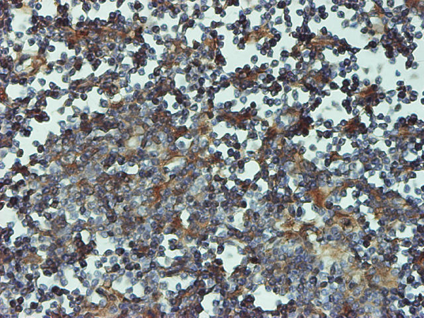 Immunoperoxidase of monoclonal antibody to PSMB6 on formalin-fixed paraffin-embedded human lymph node tissue. [antibody concentration 1 ~10 ug/ml].