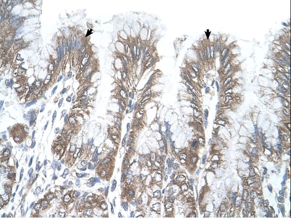 RSRC2 antibody LS-C81616 was used in IHC to stain formalin-fixed, paraffin-embedded human stomach.