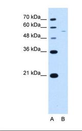 Lane A: Marker. Lane B: Jurkat cell lysate. Antibody concentration: 2.5 ug/ml. Gel concentration: 12%.