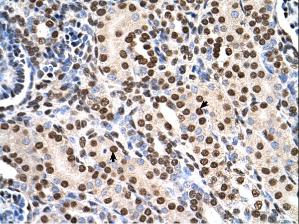 RSU1 antibody LS-C81217 was used in IHC to stain formalin-fixed, paraffin-embedded human kidney.
