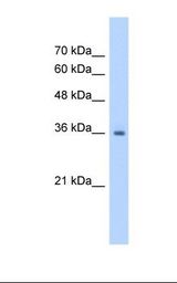 Jurkat cell lysate. Antibody concentration: 1.25 ug/ml. Gel concentration: 12%.