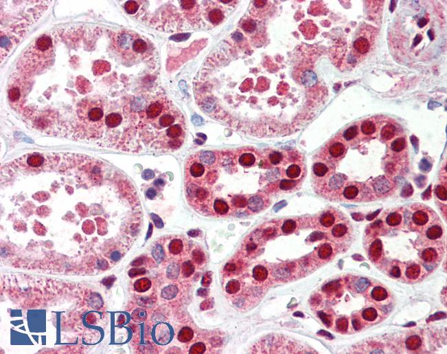 Human Kidney: Formalin-Fixed, Paraffin-Embedded (FFPE)