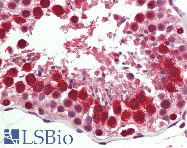 Human, Testis: Formalin-Fixed Paraffin-Embedded (FFPE)