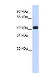 RTCD1 antibody LS-C101847 Western blot of Fetal Heart lysate.