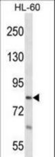 RTF1 Antibody western blot of HL-60 cell line lysates (35 ug/lane). The RTF1 antibody detected the RTF1 protein (arrow).