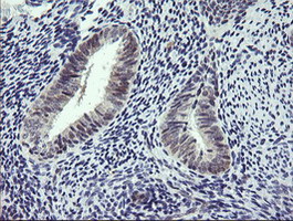 IHC of paraffin-embedded Human endometrium tissue using anti-RTKN mouse monoclonal antibody. (Heat-induced epitope retrieval by 10mM citric buffer, pH6.0, 100C for 10min).