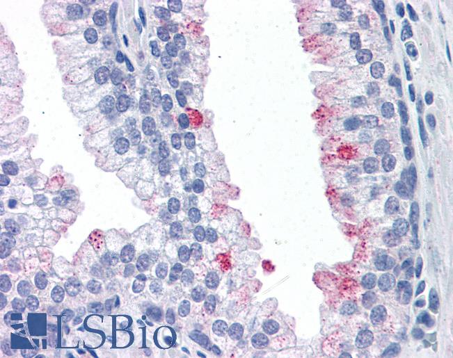 Anti-RTKN antibody IHC of human prostate. Immunohistochemistry of formalin-fixed, paraffin-embedded tissue after heat-induced antigen retrieval. Antibody LS-B4410 concentration 10 ug/ml.