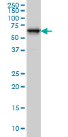 RTKN monoclonal antibody clone 2E5 Western blot of RTKN expression in A-431.