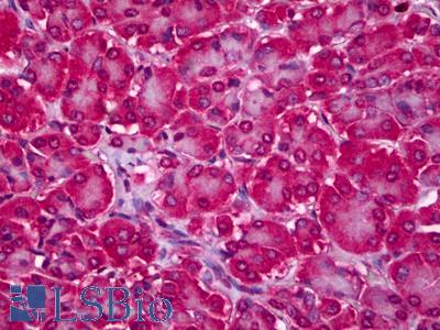 Anti-RTKN2 antibody IHC of human pancreas. Immunohistochemistry of formalin-fixed, paraffin-embedded tissue after heat-induced antigen retrieval. Antibody LS-B6720 dilution 1:50.