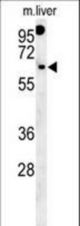 RTKN2 Antibody western blot of mouse liver tissue lysates (15 ug/lane). The RTKN2 antibody detected RTKN2 protein (arrow).
