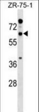 RTN2 Antibody western blot of ZR-75-1 cell line lysates (35 ug/lane). The RTN2 antibody detected the RTN2 protein (arrow).