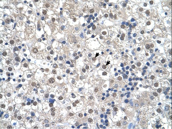 RTN2 / Reticulon 2 antibody LS-C80909 was used in IHC to stain formalin-fixed, paraffin-embedded human liver.