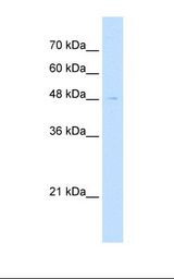 Jurkat cell lysate. Antibody concentration: 2.5 ug/ml. Gel concentration: 12%.