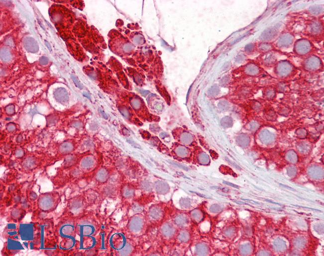 Anti-RTN4 / Nogo antibody IHC of human testis. Immunohistochemistry of formalin-fixed, paraffin-embedded tissue after heat-induced antigen retrieval. Antibody LS-B6516 dilution 1:100.