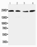 WB of RTN4 / Nogo antibody. All lanes: Anti-RTN4 at 0.5ug/ml. Lane 1: Rat Brain Tissue Lysate at 40ug. Lane 2: Rat Brain Tissue Lysate at 40ug. Lane 3: Mouse Brain Tissue Lysate at 40ug. Lane 4: Mouse Brain Tissue Lysate at 40ug. Predicted bind size: 220KD. Observed bind size: 220KD.