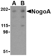 Western blot of NogoA in human brain tissue lysate with NogoA antibody at (A) 0.5 and (B) 1 ug/ml.