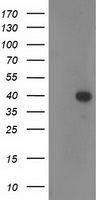 HEK293T cells were transfected with the pCMV6-ENTRY control (Left lane) or pCMV6-ENTRY RTN4IP1 (Right lane) cDNA for 48 hrs and lysed. Equivalent amounts of cell lysates (5 ug per lane) were separated by SDS-PAGE and immunoblotted with anti-RTN4IP1.