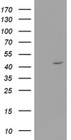 HEK293T cells were transfected with the pCMV6-ENTRY control (Left lane) or pCMV6-ENTRY RTN4IP1 (Right lane) cDNA for 48 hrs and lysed. Equivalent amounts of cell lysates (5 ug per lane) were separated by SDS-PAGE and immunoblotted with anti-RTN4IP1.