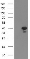 HEK293T cells were transfected with the pCMV6-ENTRY control (Left lane) or pCMV6-ENTRY RTN4IP1 (Right lane) cDNA for 48 hrs and lysed. Equivalent amounts of cell lysates (5 ug per lane) were separated by SDS-PAGE and immunoblotted with anti-RTN4IP1.