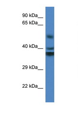 RTN4IP1 antibody LS-C135846 Western blot of Fetal Kidney lysate. Antibody concentration 1 ug/ml.