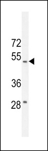RT4I1 Antibody western blot of WiDr cell line lysates (35 ug/lane). The RT4I1 antibody detected the RT4I1 protein (arrow).