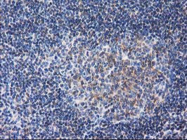 IHC of paraffin-embedded Human lymph node tissue using anti-RTN4IP1 mouse monoclonal antibody.