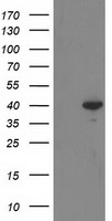 HEK293T cells were transfected with the pCMV6-ENTRY control (Left lane) or pCMV6-ENTRY RTN4IP1 (Right lane) cDNA for 48 hrs and lysed. Equivalent amounts of cell lysates (5 ug per lane) were separated by SDS-PAGE and immunoblotted with anti-RTN4IP1.