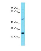 Western blot of RTN4RL1 Antibody - C-terminal region with human OVCAR-3 cells lysate.