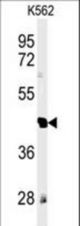 Western blot of RTN4RL1 Antibody in K562 cell line lysates (35 ug/lane). RTN4RL1 (arrow) was detected using the purified antibody.