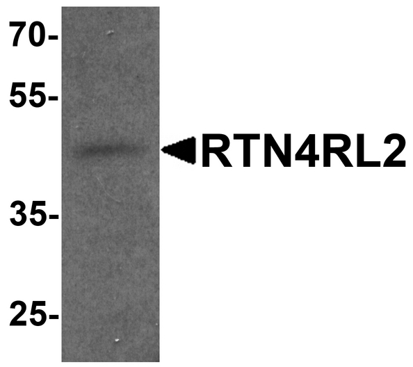 Western blot analysis of RTN4RL2 in rat brain tissue lysate with RTN4RL2 antibody at 1 ug/ml.