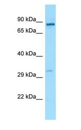 RTP1 antibody Western Blot of MCF7.
