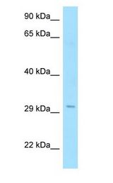 RTP1 antibody Western Blot of Fetal Heart.