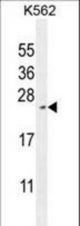 RTP4 Antibody western blot of K562 cell line lysates (35 ug/lane). The RTP4 antibody detected the RTP4 protein (arrow).