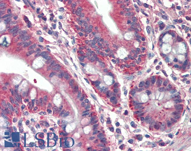 Human, Small intestine: Formalin-Fixed Paraffin-Embedded (FFPE)