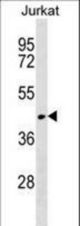 RUNDC3A Antibody western blot of Jurkat cell line lysates (35 ug/lane). The RUNDC3A antibody detected the RUNDC3A protein (arrow).