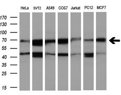 Western blot of extracts (10ug) from 7 different cell lines by using anti-RUNX1T1 monoclonal antibody at 1:200 dilution.