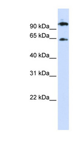 RUNX1T1 antibody LS-C112160 Western blot of 293T cell lysate.
