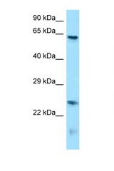 RUNX1T1 antibody LS-C146291 Western blot of Mouse Brain lysate. Antibody concentration 1 ug/ml.