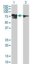 Western Blot analysis of RUNX1T1 expression in transfected 293T cell line by RUNX1T1 monoclonal antibody (M01), clone 5A12.Lane 1: RUNX1T1 transfected lysate(67.566 KDa).Lane 2: Non-transfected lysate.